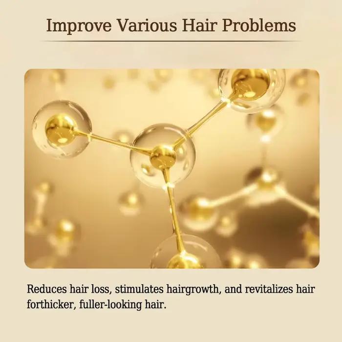 SF52 traitements du cuir chevelu produit de croissance des cheveux prévenir le traitement de la calvitie Anti perte de cheveux sérum Spray cuir chevelu barbe beauté soins capillaires Pr